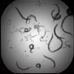 Rundmaskar, bild från mikroskop